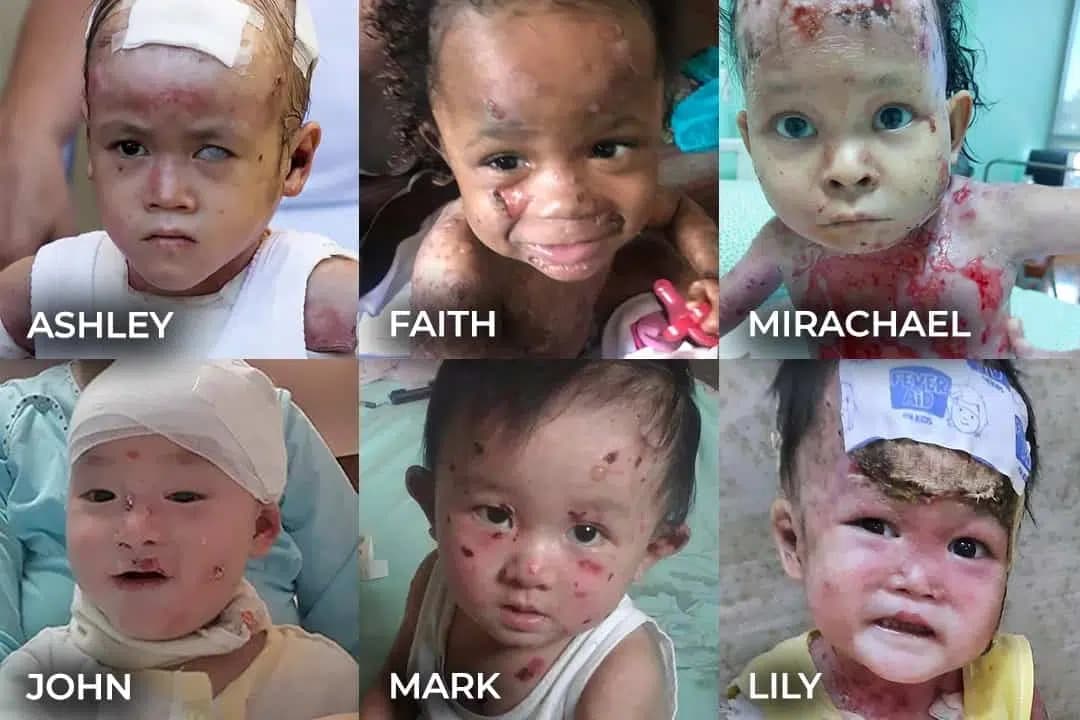Global Glow Kids tarafından desteklenen çocuklar
