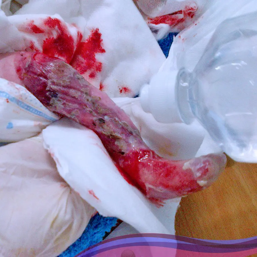 Global Glow Kids tarafından desteklenen çocuk