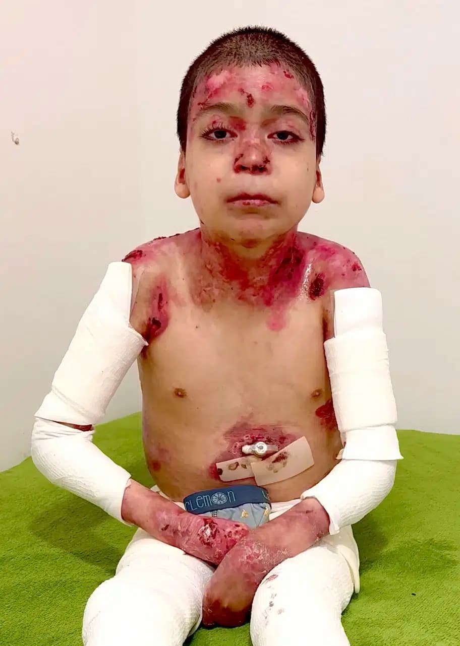 Global Glow Kids tarafından desteklenen çocuk