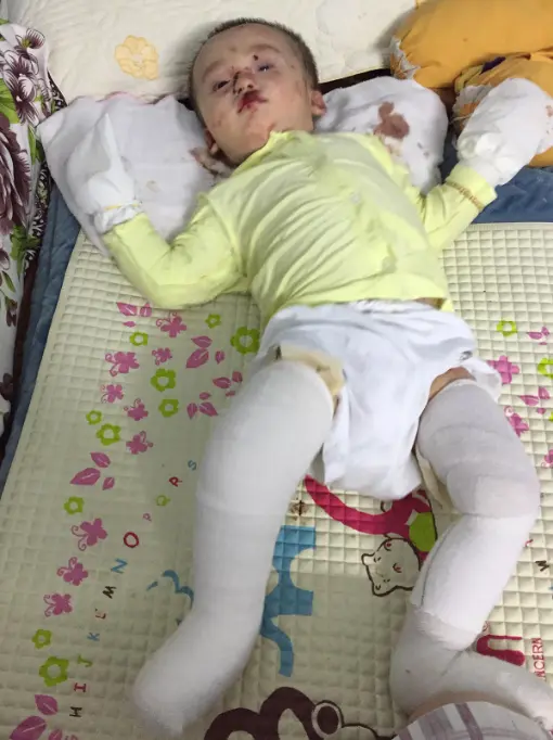 Global Glow Kids tarafından desteklenen çocuk