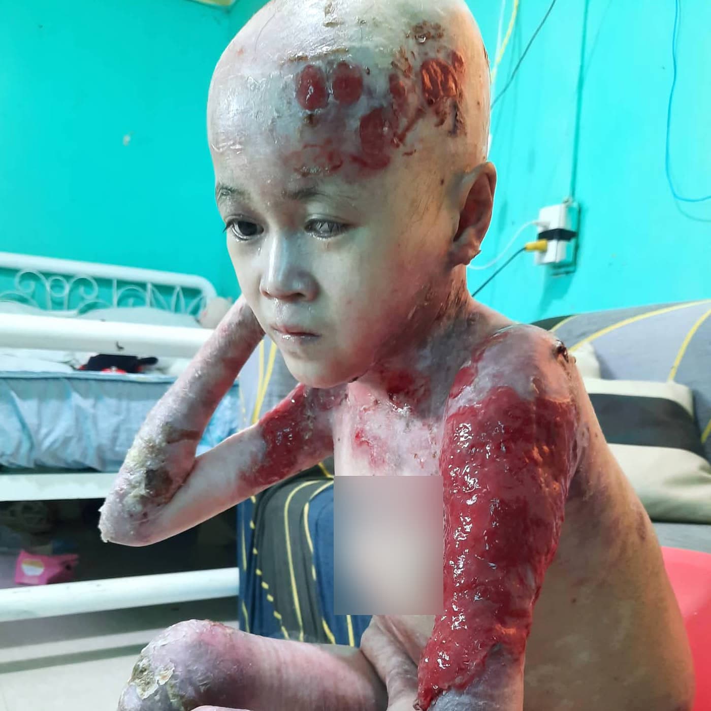 Global Glow Kids tarafından desteklenen çocuk